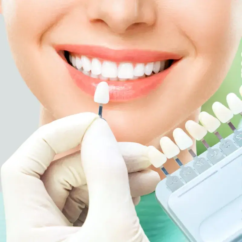 Cosmetic Dentistry