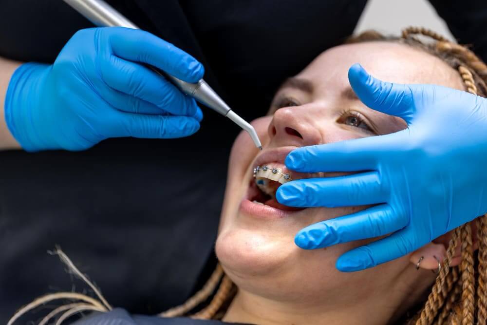 Metal Braces