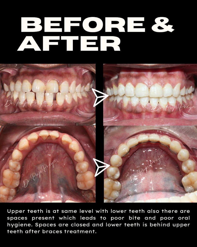 patient tranformation